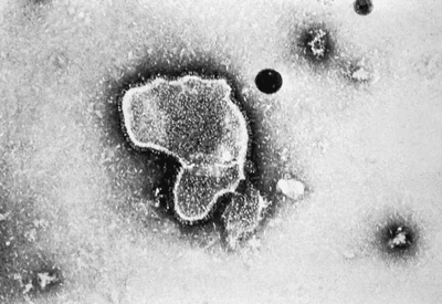HPMV: VÍRUS QUE VEM SE ESPALHANDO NA CHINA PODE SE TORNAR UMA PANDEMIA? ENTENDA