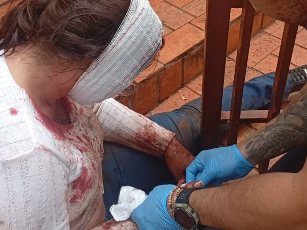 Mulher é atacada por pitbull ao tentar salvar sua cadela em Campo Grande